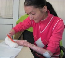 Apel umanitar: Oana suferă de o maladie rară care îi macină pielea și oasele