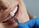 Ce opțiuni de tratament ai pentru a înlocui dinții pierduți