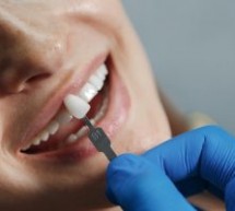 Ce opțiuni de tratament ai pentru a înlocui dinții pierduți